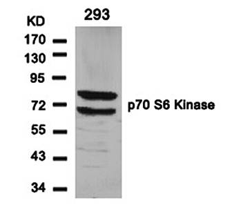 p70 S6 Kinase (Ab-411) Antibody