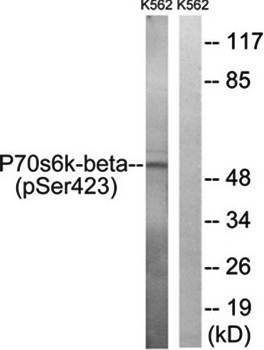 p70 S6 Kinase beta (phospho-Ser423) antibody