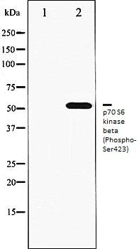 p70 S6 kinase beta (Phospho-Ser423) antibody