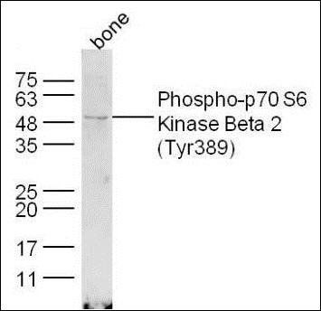 p70 S6 Kinase Beta (phospho-Thr389) antibody