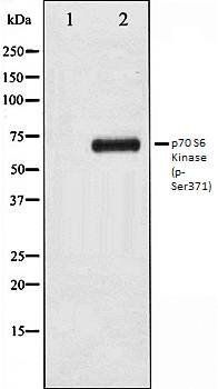 p70 S6 Kinase (phospho-Ser371) antibody