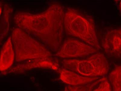 p70 S6 Kinase (Phospho-Ser411) Antibody