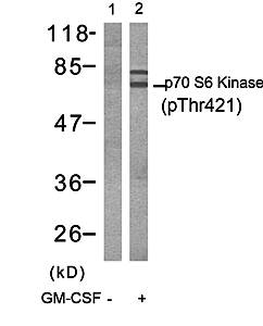 p70 S6 Kinase (Phospho-Thr421) Antibody