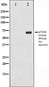 p70 S6 kinase (Phospho-Ser424) antibody