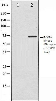 p70 S6 kinase (Phospho-Thr389/412) antibody