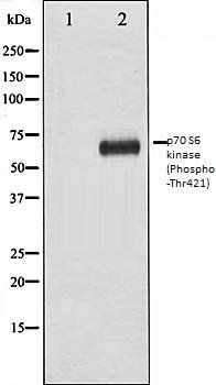 p70 S6 kinase (Phospho-Thr421) antibody
