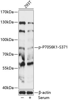 P70S6K1 (Phospho-S371) antibody
