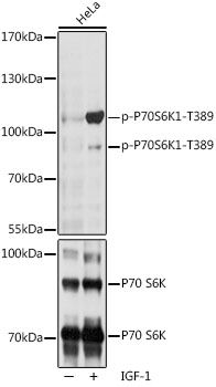 P70S6K1 (Phospho-T389) antibody