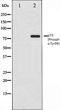p73 (Phospho-Tyr99) antibody