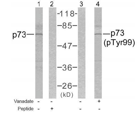 p73 (Phospho-Tyr99) Antibody