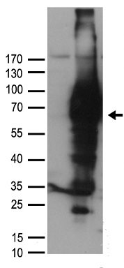 p75 NGF Receptor (NGFR) antibody
