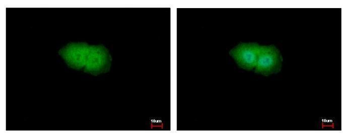p90 RSK1 Rabbit Polyclonal Antibody