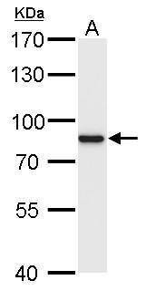 p90 RSK1 Rabbit Polyclonal Antibody