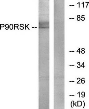 p90 RSK antibody