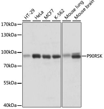P90RSK antibody