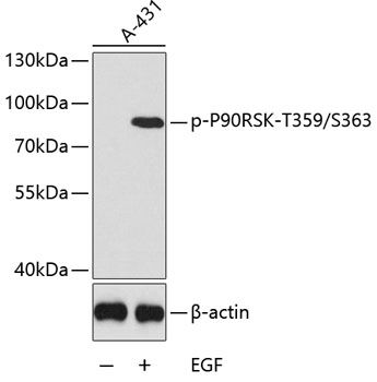 P90RSK (Phospho-T359/S363) antibody