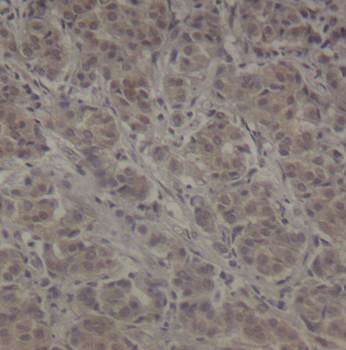 p90RSK (Ab-352) Antibody