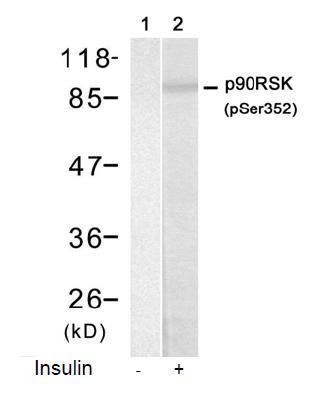 p90RSK (Phospho-Ser352) Antibody