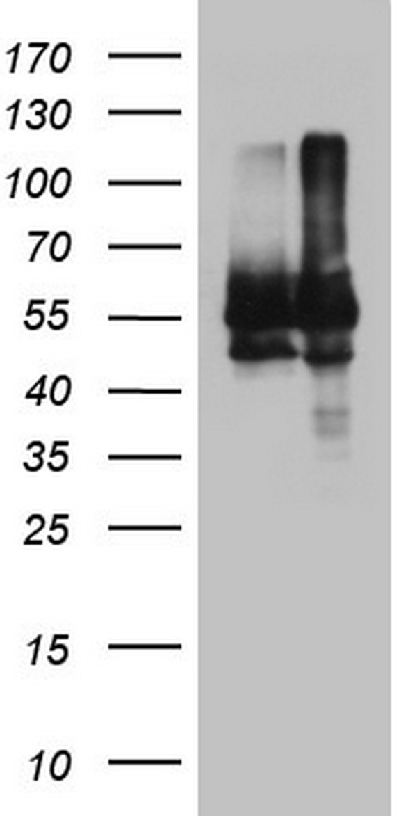 p95 NBS1 Antibody
