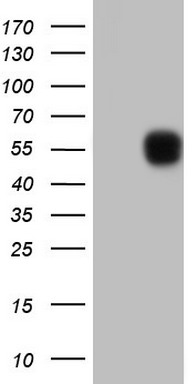 p95 NBS1 (NBN) antibody