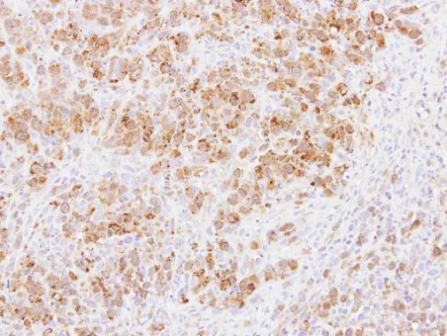 PABPC3 antibody [N2C1], Internal