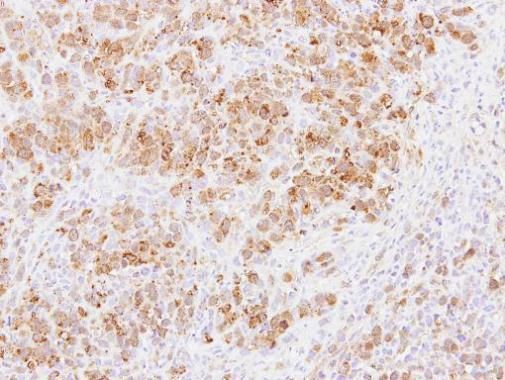 PABPC3 antibody