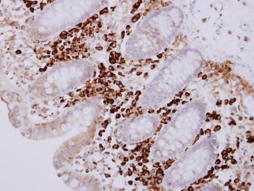 PACAP antibody [N1C3]