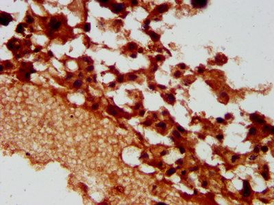 PACS2 Antibody