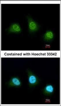 PAD4 antibody