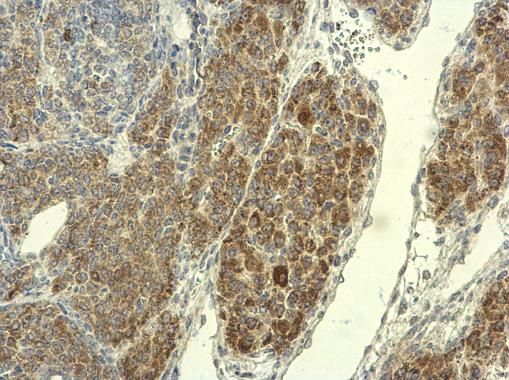PAD4 Rabbit Polyclonal Antibody