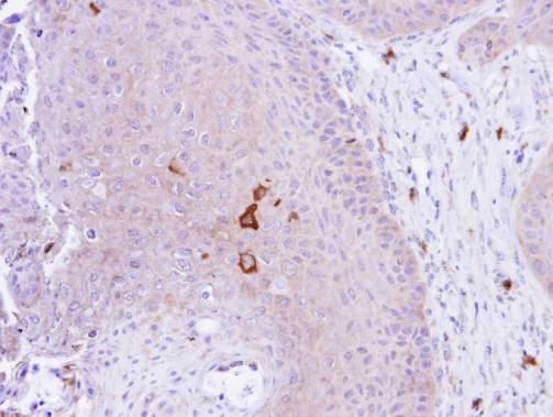 PAD4 Rabbit Polyclonal Antibody