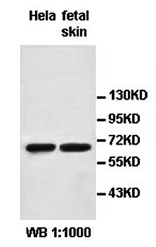 PADI3 antibody