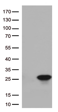 PADI4 antibody