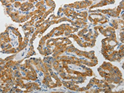PADI4 Antibody