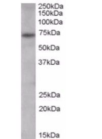 Goat anti-PAD4 / PADI4 Antibody