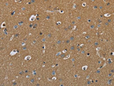PAEP Antibody