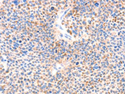PAFAH2 Antibody