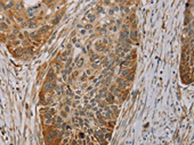 PAGE2 Antibody