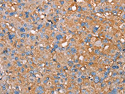PAGE5 Antibody