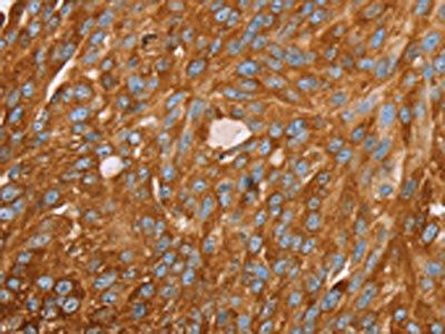 PAICS Antibody