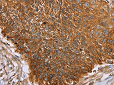 PAICS Antibody