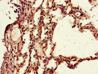 PAIP2 antibody