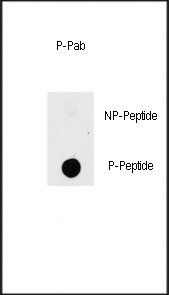 PAK1 (phospho-Thr423) antibody