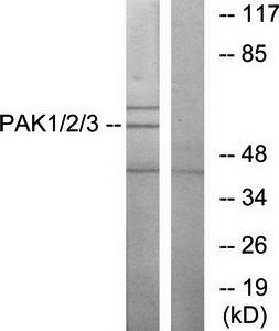 PAK1/2/3 antibody