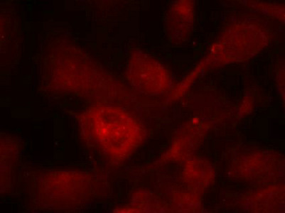 PAK1/PAK2/PAK3 (Ab-423/402/421) Antibody