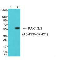 PAK1 (Ab-423/402/421) antibody