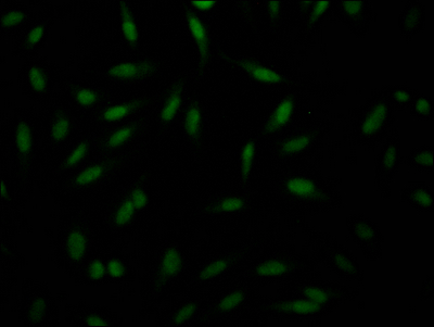 PAK1 Recombinant Monoclonal Antibody