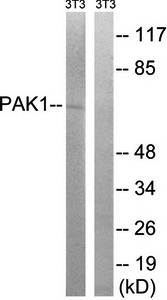 PAK1 (Ab-204) Antibody