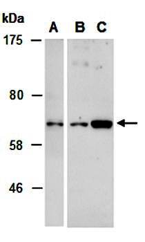 PAK1 (N2) Antibody, Rabbit Polyclonal