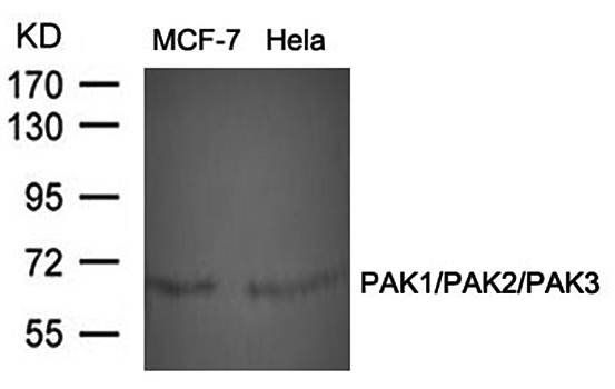 PAK1/PAK2/PAK3 (Ab-423/402/421) Antibody